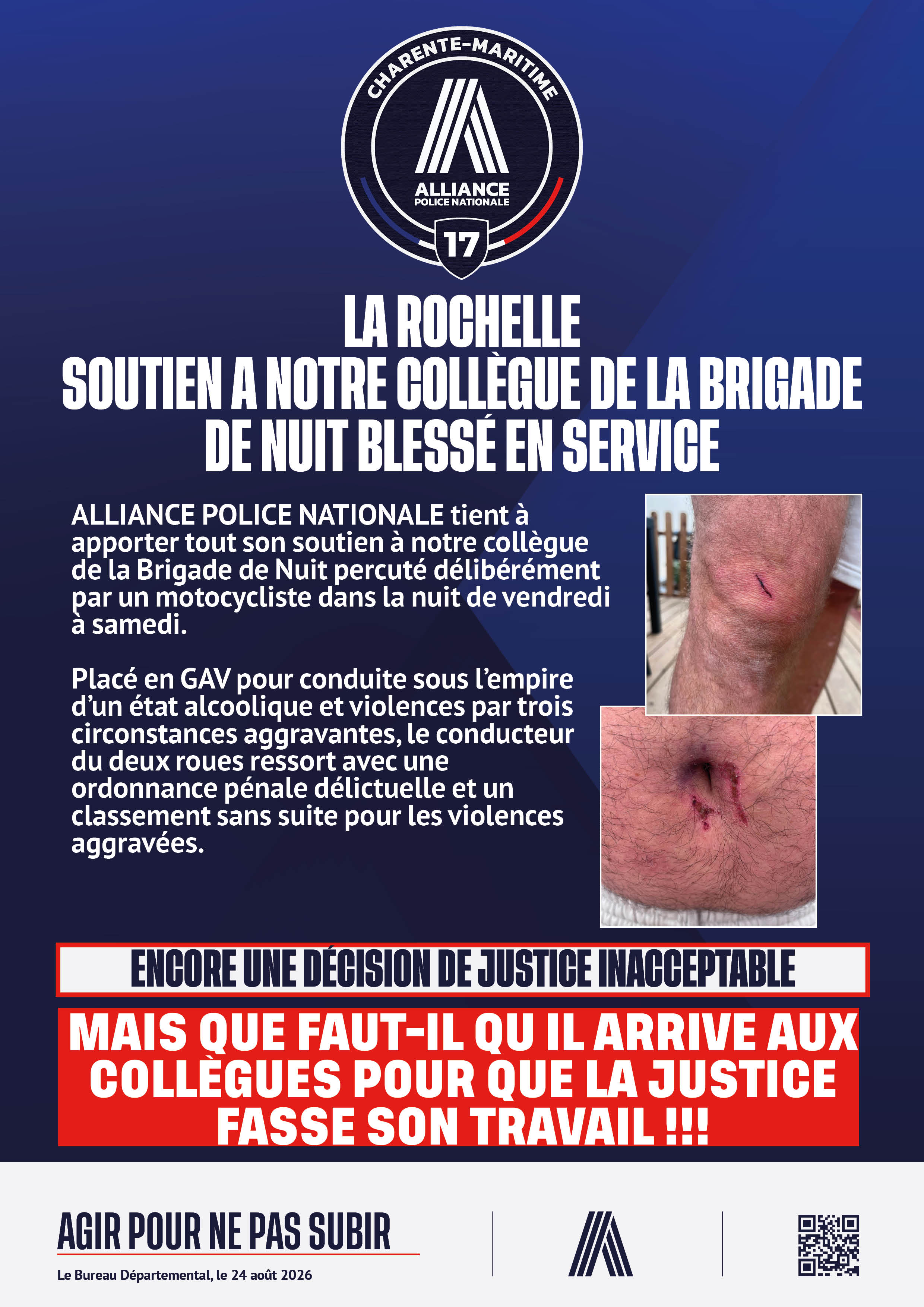 LA ROCHELLE SOUTIEN A NOTRE COLLÈGUE DE LA BRIGADE DE NUIT BLESSÉ EN SERVICE